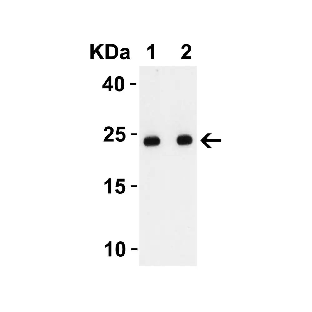 ProSci 9169 SARS-CoV-2 (COVID-19) Envelope Antibody, ProSci, 0.1 mg/Unit Secondary Image